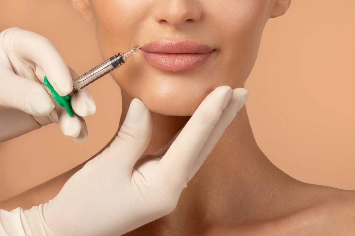 Are Lip Fillers Right for Everyone?